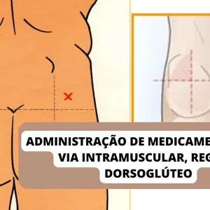 Imagem de capa para o Ebook Administração de medicamentos por Via Intramuscular, REGIÃO Dorsoglúteo