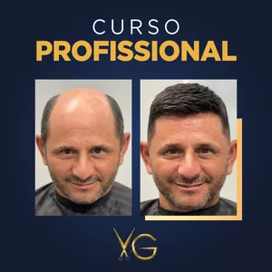 Curso Profissionalizante de Prótese Capilar