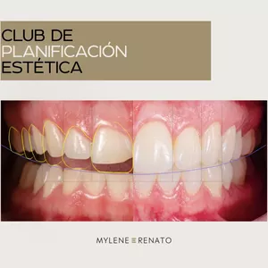 Imagen de portada para Curso online CLUB DE PLANIFICACIÓN ESTÉTICA
