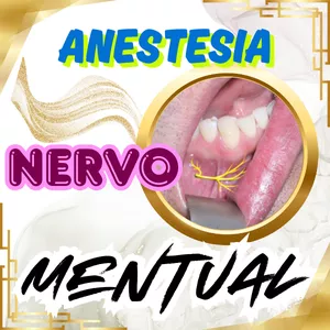 Imagem de capa para o Ebook PDF - PASSO A PASSO e características da ANESTESIA DO NERVO MENTUAL - Aula 109
