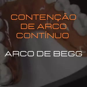 Imagem do curso Contenção de arco contínuo (arco de Begg)