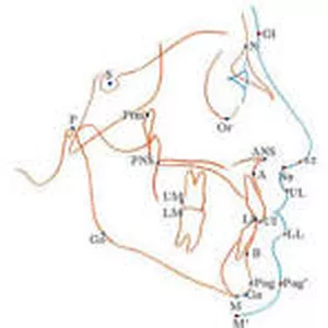 Imagen de portada para Curso online puntos cefalometricos