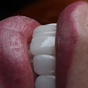 Cover image for In-person event Smile Design &amp; SKYN Concept