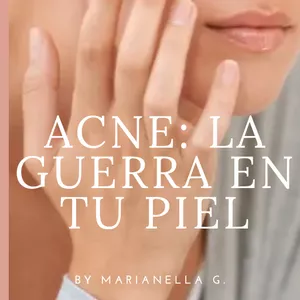 Imagen de portada para Ebook ACNE, LA GUERRA EN TU PIEL