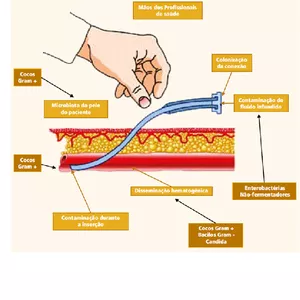 Imagem de capa para o Curso online Prevenção de Infecção Primária da Corrente Sanguínea Associada a Cateter