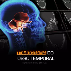 Imagem de Tomografia do Osso Temporal criado por OTOFLIX na hotmart