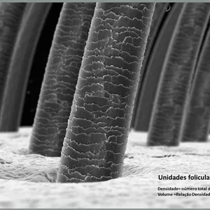 Imagem de capa para o Serviço online Tratamento Capilar Avançado