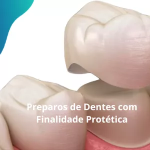 Imagem de capa para o Ebook Caderno de Prótese: Preparos de Dentes com Finalidade Protética
