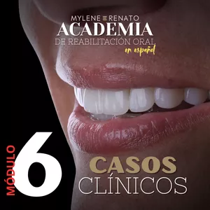 Imagen de portada para Curso online ACADEMIA DE REHABILITACIÓN ORAL MYLENE Y RENATO - MÓDULO 6: CASOS CLÍNICOS