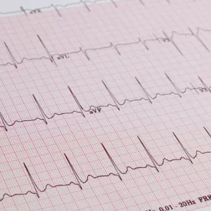 Imagen de portada para Curso online SOPORTE PREMIUM