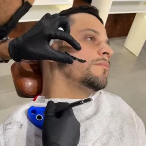 Curso PREENCHIMENTO DE BARBA E PREENCHIMENTO CAPILAR - NANOBLANDING FIO A FIO
