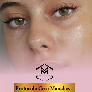 Imagen de portada para Ebook Protocolo Cero Manchas