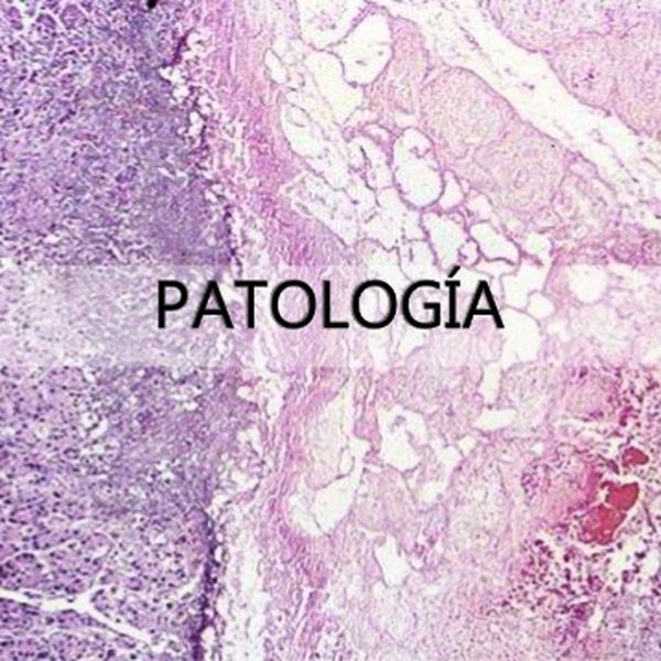Patologia principios básicos - mavmedicina - learn a new skill ...