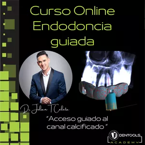 Imagen de portada para Evento online Curso Online Endodoncia guiada. Planificación digital para conductos calcificados 