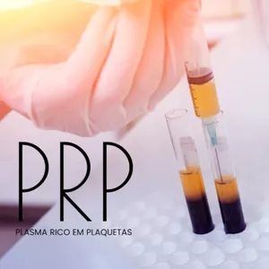 Imagem do curso PRP Plasma Rico em Plaquetas- Estético