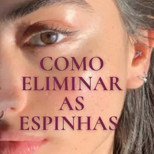 Imagem de capa para o Ebook Como Eliminar as Espinhas 