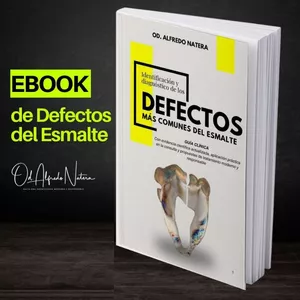 Imagen de portada para Curso online EBOOK IDENTIFICACIÓN Y DIAGNÓSTICO DE LOS DEFECTOS MAS COMUNES DEL ESMALTE