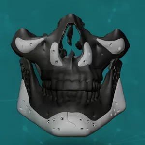 Imagem de capa para o Curso online Pós-Graduação em Implantes Faciais com Dr. Andrey Moreira