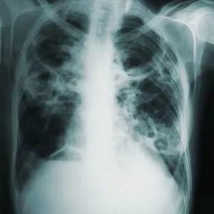 Imagem de capa para o Ebook Radiologia Técnica: Métodos de Estudo e Práticas Essenciais