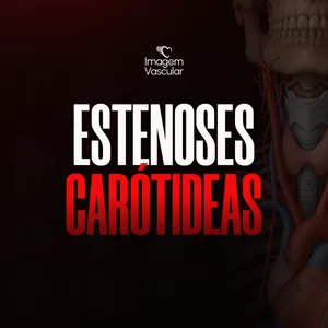 Imagem de capa para o Curso online Estenose Carotidea