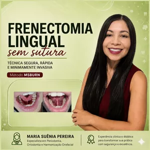 Imagem de Frenectomia lingual sem sutura criado por MARIA SUENIA PEREIRA DA SILVA na hotmart