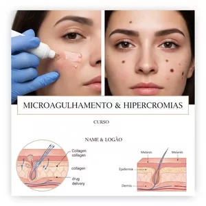 Imagem de capa para o Curso online Curso Microagulhamento 