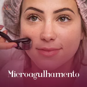 Imagen de portada para Curso online [Curso] Microagulhamento Skinbooster