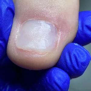 Imagem de capa para o Curso online Reconstrução Ungueal com Alê Nogueira