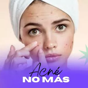 Imagen de portada para Ebook Una guía natural y casera que elimina los puntos negros y los granos en solo unos pocos días.