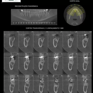 Imagem de capa para o Curso online Tomografia Odontológica para clínicos 