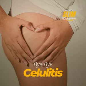 Imagen de portada para Servicio online Bye Bye Celulitis: Recupera tu Confianza (80% comisión para AFILIADOS)