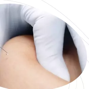 Curso Curso de Hipodermóclise 