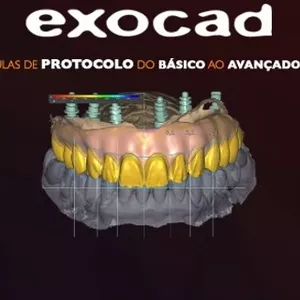 Imagem de capa para o Curso online Curso de Exocad do Basico ao Avançado + brinde
