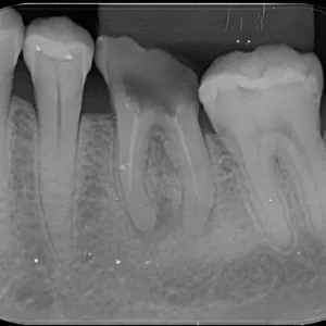 Imagem de capa para o Curso online SOLICITAÇÃO DE RX