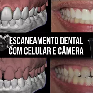 Imagem de capa para o Curso online ESCANEAMENTO DENTAL COM CELULAR E CÂMERA