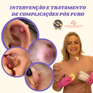 Imagem de INTERVENÇÃO E TRATAMENTO DE COMPLICAÇÕES PÓS FURO - MDC (Método Dominando as Complicações) criado por Adri Furo Humanizado na hotmart