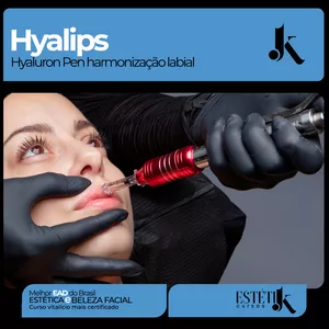 Curso Harmonização labial com Hyaluron Pen