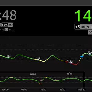 Imagem de capa para o Serviço online Criação do Nightscout - DESATIVADO