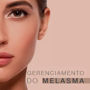 Imagem de capa para o Ebook Melasma - Protocolo de Gerenciamento