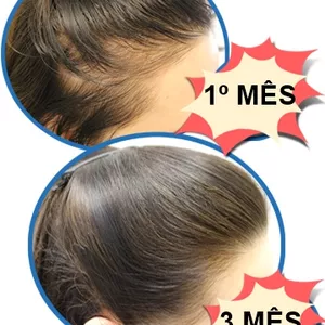 Imagem de capa para o Ebook 6 PASSOS PARA ACABAR COM A QUEDA DE CABELO