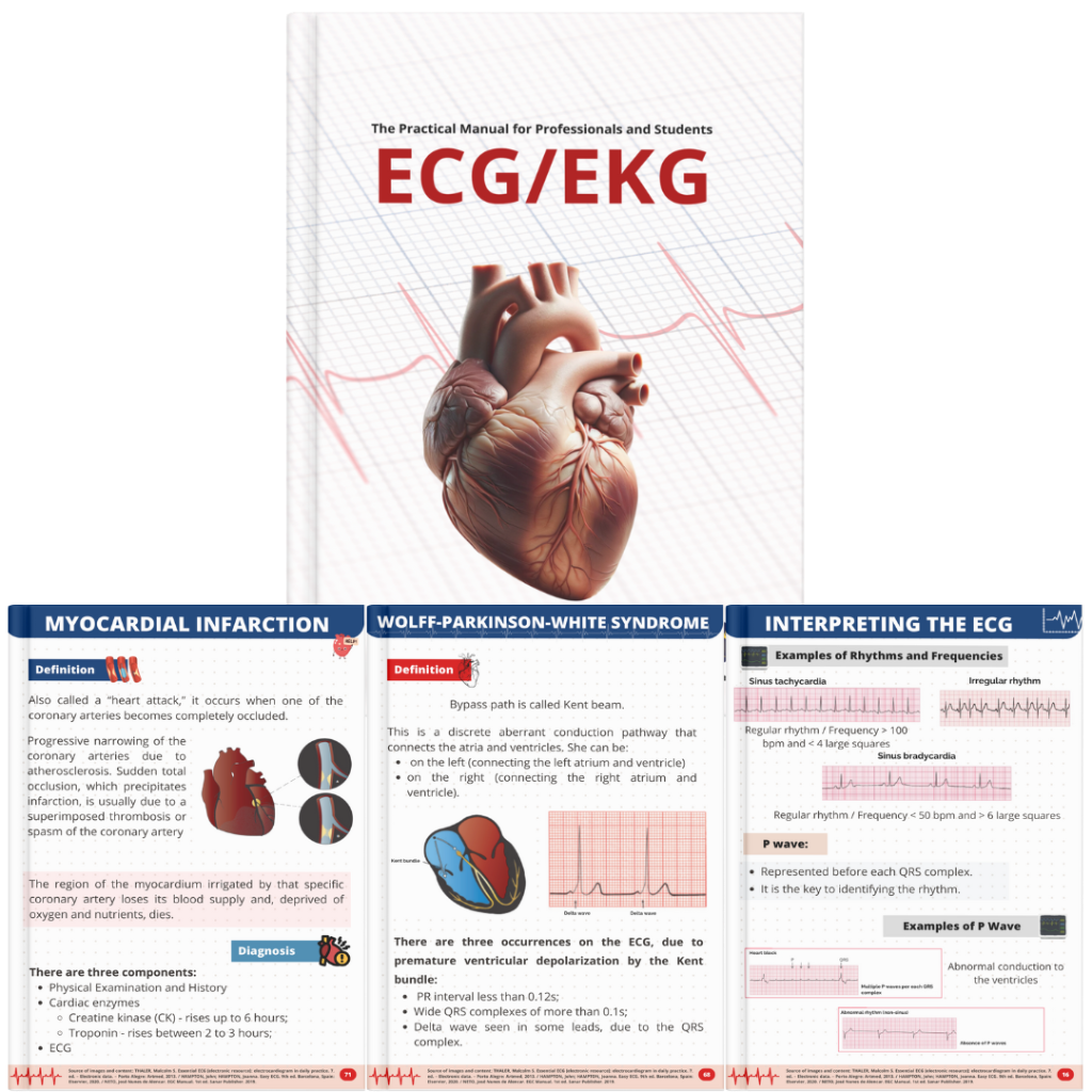 the-practical-manual-ecg-ekg-for-professionals-and-students