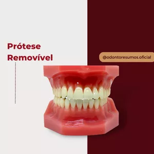 Imagem de capa para o Ebook Prótese Removível - Resumo