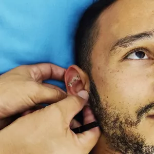 Imagem de capa para o Curso online Formação Profissional em Auriculoterapia