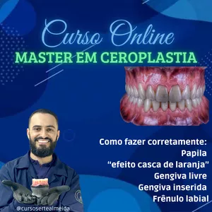 Imagem principal do produto CURSO MASTER EM CEROPLASTIA DE PRÓTESE TOTAL