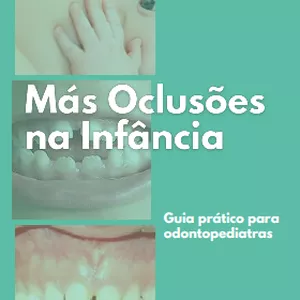 Imagem de capa para o Ebook Más Oclusões na Infância: Guia para Odontopediatras