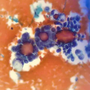 Imagen de portada para Curso online Introducción a la citologia cervico vaginal