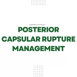 Cover image for Online course Posterior Capsular Rupture Management