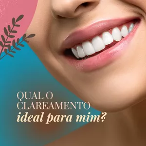 Imagem de capa para o Ebook Clareamento Dental: O Guia Definitivo para Ter Um Sorriso Brilhante