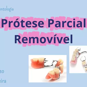 Imagem de capa para o Ebook Resumo de Prótese Parcial Removível