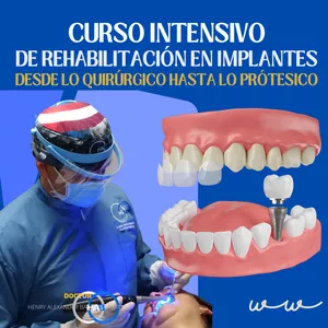 Imagen de portada para Curso online Curso en Rehabilitación Oral Sobre Implantes Dentales